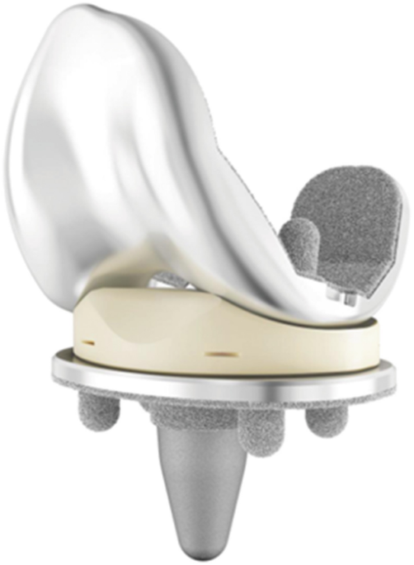 Total Knee Replacement